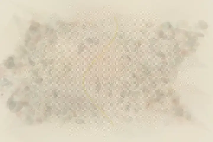 Quiet Wound Assembly: cumulative painting state 1 of 3; An asymmetric living field stages cells gather at the quiet wound. through pressure, granular deposits, abrasion, and exposed support.